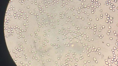 水解啤酒廢酵母生產(chǎn)蛋白飼料的酶制劑有哪些？